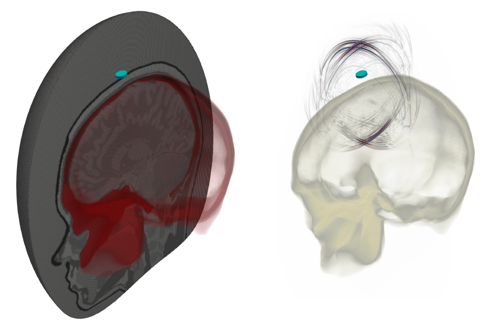 04_transcranial_mesh.png
